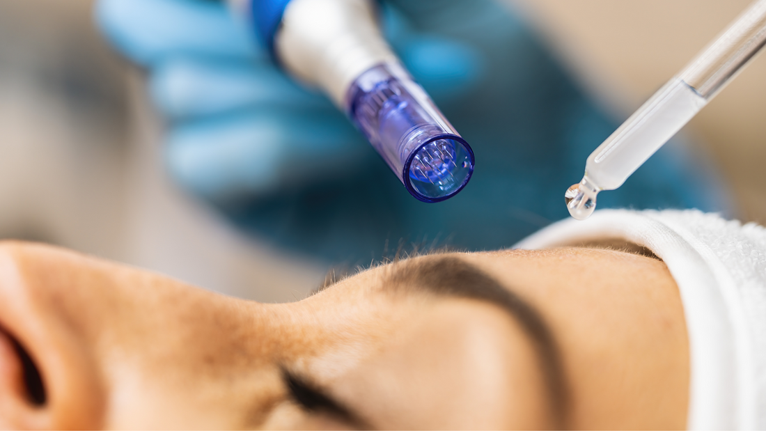 Unlock Radiant Skin with Microneedling: Your Path to Flawless Skin